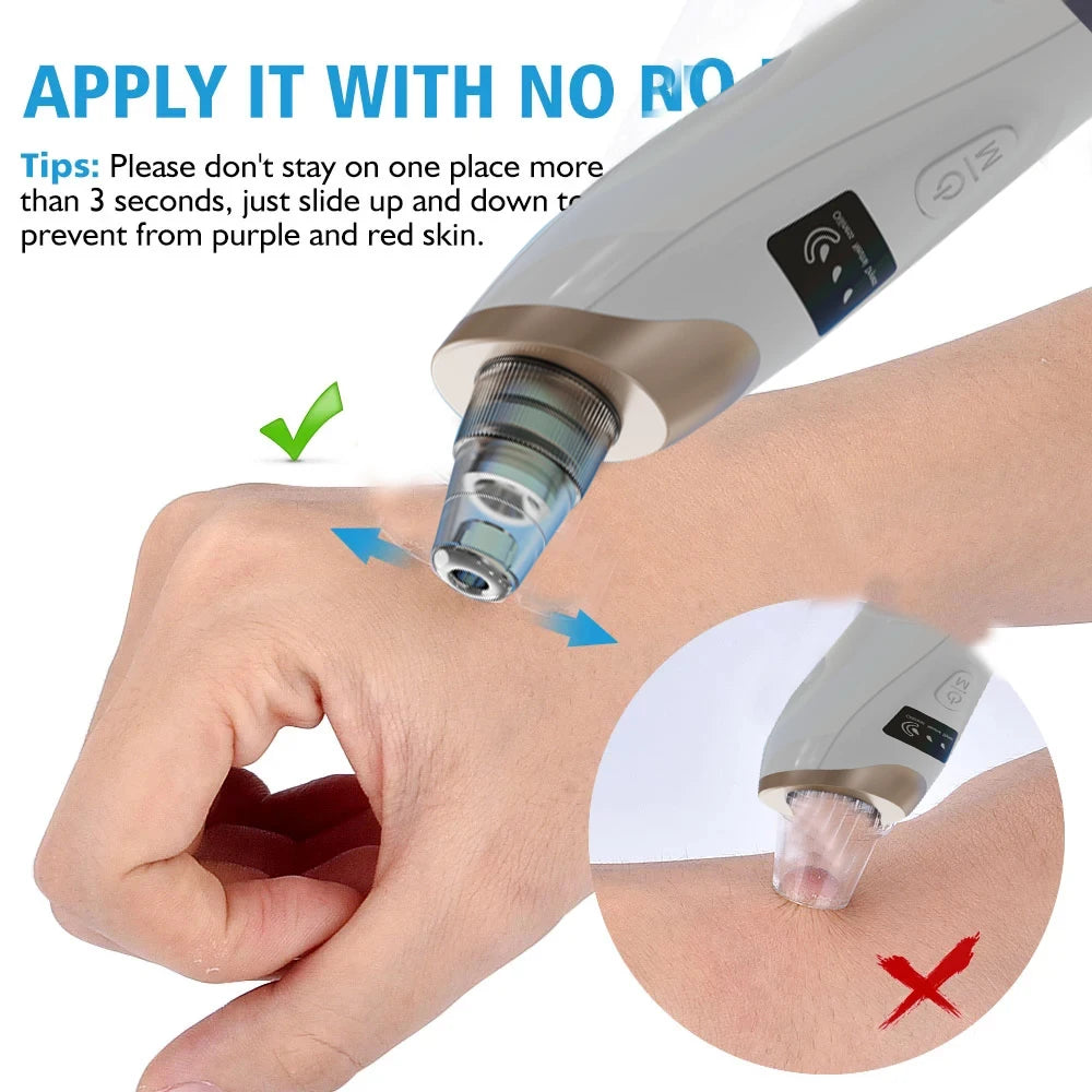 5-u-1 uređaj za uklanjanje mitesera