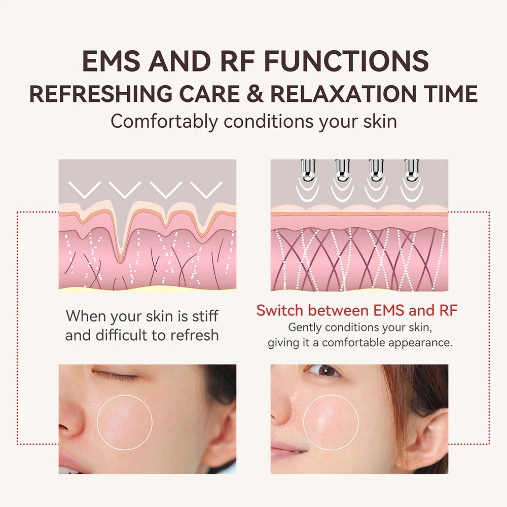 ANLAN RF i EMS masažer za lice – uređaj s dvostrukom glavom za zatezanje kože i njegu lica