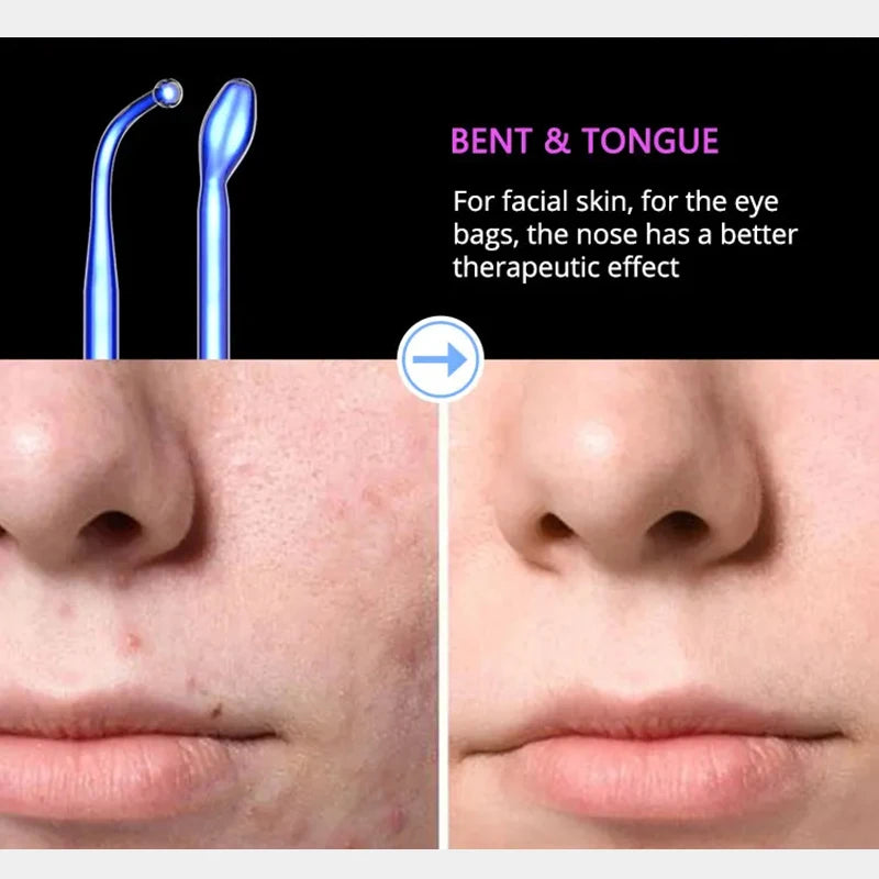 DARSONVAL profesionalni visokofrekventni uređaj za lice – neon i argon terapija za pomlađivanje kože, tretman akni i stimulaciju kose.