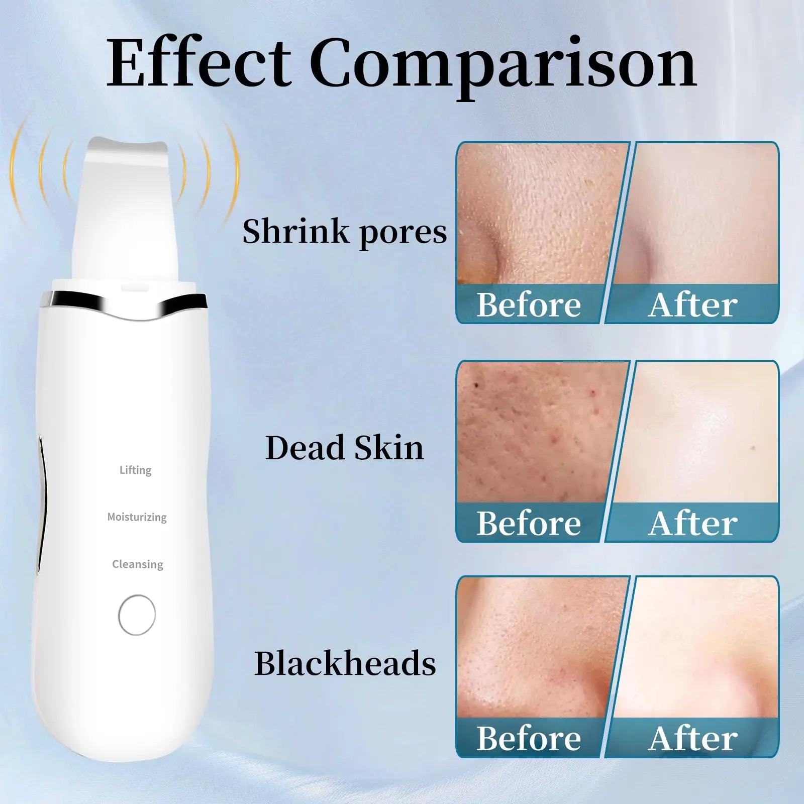 Ultrasonic Skin Scrubber – uređaj za dubinsko čišćenje lica